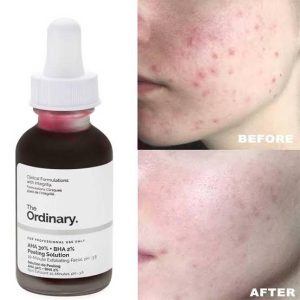 Peelling Solution – The Ordinary